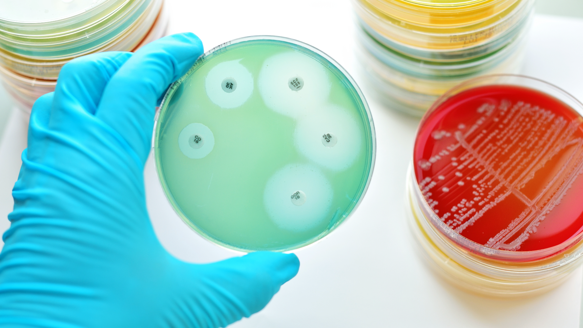hand in surgical glove with petri dishes