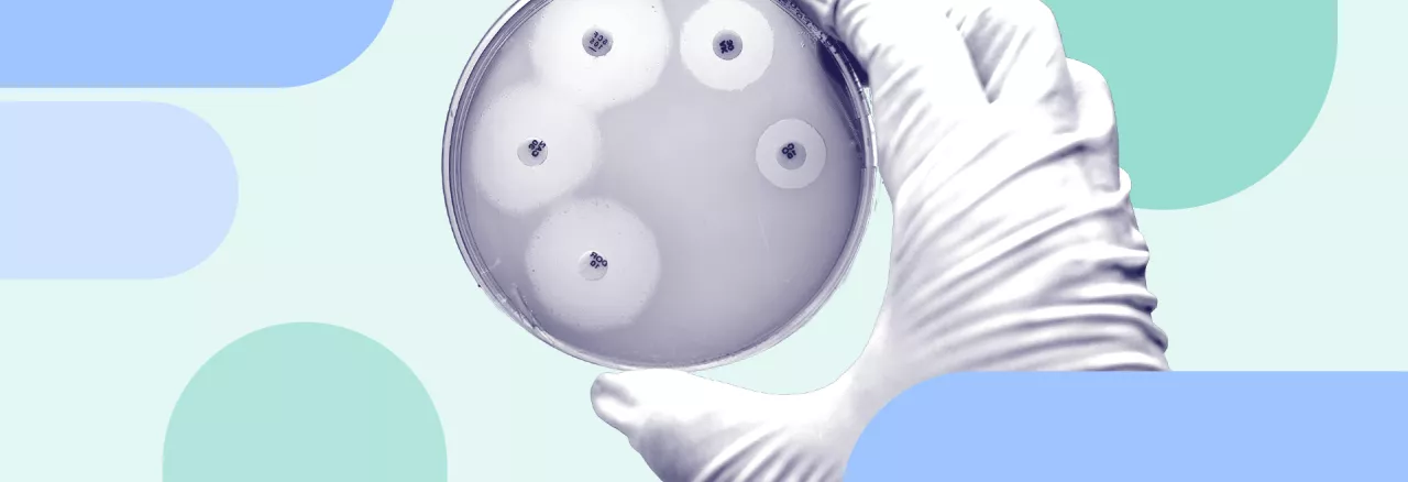 Hand holding a petri dish