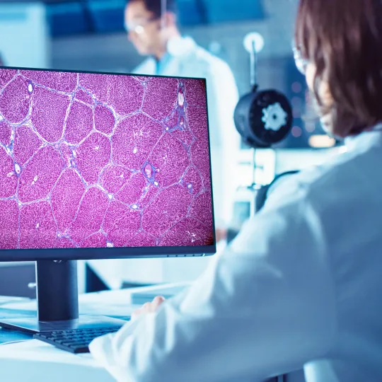 Scientist looking at screen with magnified cells