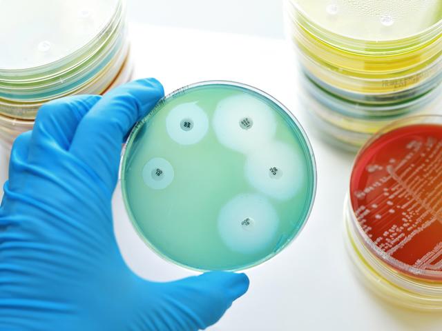amr_guideline.jpg Antimicrobial resistance guideline